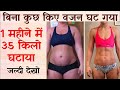 Lose Weight, Weight Loss Method, Reduce Obesity, Weight Loss Method, Obesity Weight Loss Ep 25