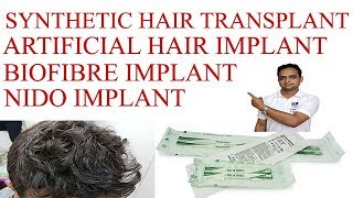 Synthetic Hair Transplant|Artificial |Biofibre|Nido|Hair Implant