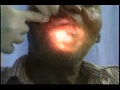 MDS 3.0 Oral Assessment Video