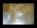 shatter