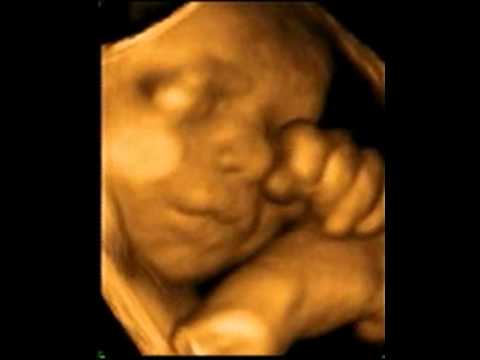 24 weeks pregnant 4d ultrasound