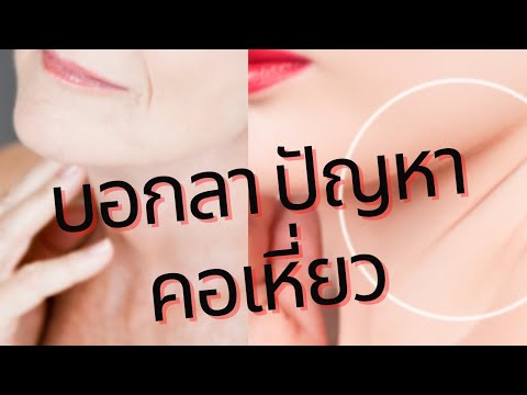 บอกลา ปัญหา คอเหี่ยว Neck Cream Giffarine