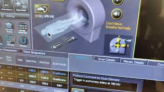 Tips On Technical Factors For Ct Pulmonary Angio Scans Contrast Bolus Iv Access