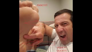 Plantar Fasciitis,Pes Planus,Mallet Toe,High Arched Feet,Heel Spur,Heel Pain,Hammer Toe,Hallux Valgus,Foot Pain,Foot Hard Skin,Foot Conditions,Foot Callous,Flat Feet,Fallen Arches,Diabetic Foot,Contracted Toe,Claw Toe,Bunions Hard Skin,Bunions Callous,Bunion Pain,Ball Of Foot Pain,Back Pain