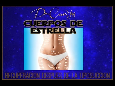 Liposuction | Lipo Recovery | Dr Cortes Liposuction | Lipo Recovery | Dr Cortes