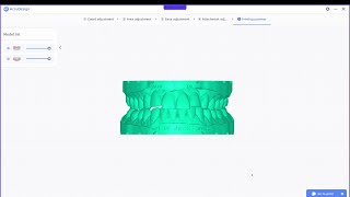How To 3D Print A Dental Model From Intraoral Scan Shining Accudesign Full Tutorial