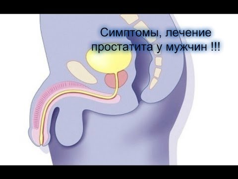 Симптомы простатита лечение в домашних условиях Симптомы простатита лечение в домашних условиях