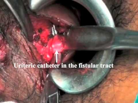 the vintage doctor sex gratuit webcam