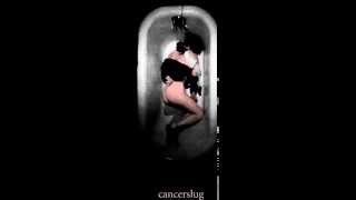 Watch Cancerslug There Is No End video