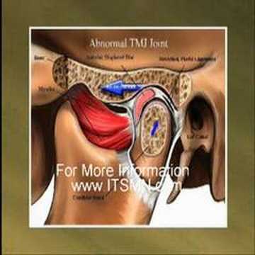 Craniofacial Resection & Reconstruction