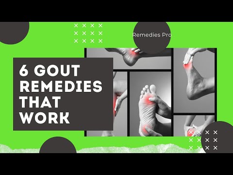 6 Gout Remedies That Work