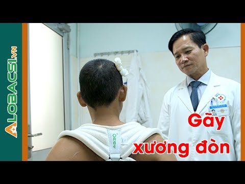 Người bị Gãy Xương Đòn cần chữa trị, chăm sóc như thế nào?
