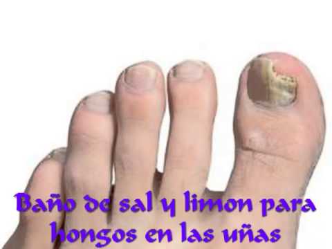 Donde comprar la medicina contra el hongo trosyd