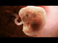 El Milagro y Odisea de la Vida