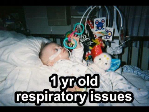My Son Joe - Tetrasomy 8p + Mosaic Down Syndrome - Part 1 Disabled Medical/Life