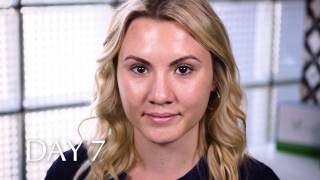 The Beauty of Peeling | V Boutique | Dr. V - Neda Vanden Bosch MSPB