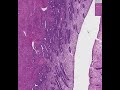 endometrium