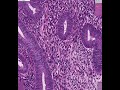 endometrium