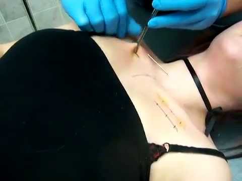 me getting my clavicles pierced! you know you desire them!