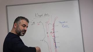 Klippel Trenaunay Weber Sendromu Tedavisi - Prof. Dr. Ahmet Akgul