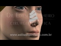 brazil plastic surgery