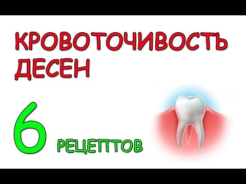 Чем лечит кровоточивость десен в домашних условиях Чем лечит кровоточивость десен в домашних условиях