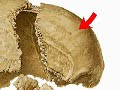 The Skull