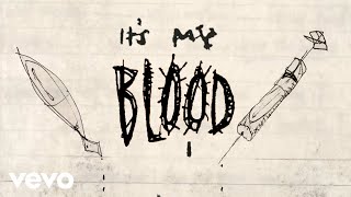 Watch Pearl Jam Blood video