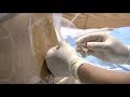 Epidural injection procedure