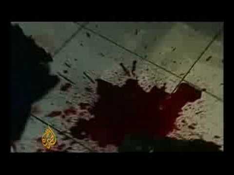 Casualties and damage in the S Ossetian conflict - 09 Aug 08