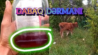 Dabaq Xəstəli̇yi̇ni̇n Dərmanini Tapdim