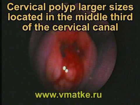 nice medication for awful sinus headache continual nasal congestion when mendacity down