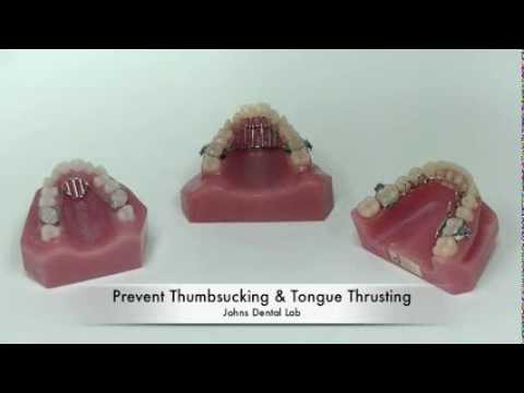 Treating tongue tie in adults