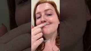 Skin Cancer Exam At The Dermatologist