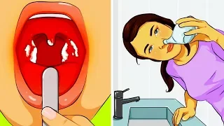 15 NATURAL WAYS TO CURE COMMON AILMENTS