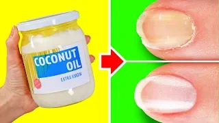 34 DIY NATURAL HOME REMEDIES