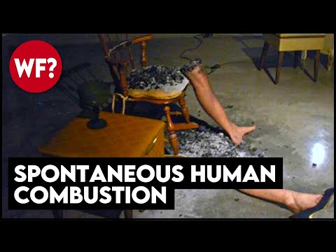Only The Legs Remain Spontaneous Human Combustion