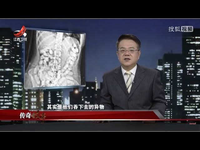 传奇故事 长在手臂上的耳朵1818 Litetube 传奇故事 长在手臂上的耳朵1818 Litetube
