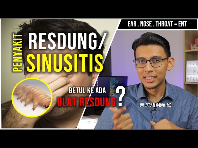Hidung Tersumbat Resdung Apa Nak Buat Litetube