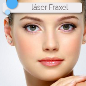 Eliminar Estrias Con Laser Antes Y Despues Veronica Youtube