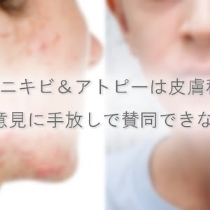 ニキビは皮膚科に 行っても治らなかった人たちへ 基本的なニキビの原因と種類 ニキビ対策スキンケア 前編 Youtube ニキビは皮膚科に 行っても治らなかった人たちへ 基本的なニキビの原因と種類 ニキビ対策スキンケア 前編 Youtube