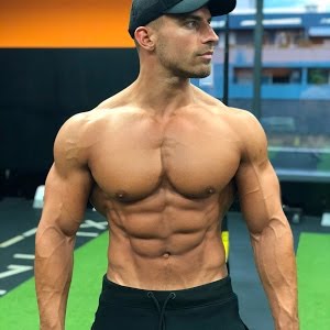 My Hair Loss Journey Fue Transplant In London Youtube