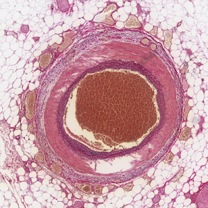 Histology Of Arteries Veins And Capillaries Preview Microscopic Anatomy Kenhub Youtube Histology Of Arteries Veins And Capillaries Preview Microscopic Anatomy Kenhub Youtube