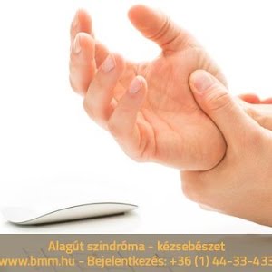 alagút szindróma milgamma kenőcsök a térdízületre