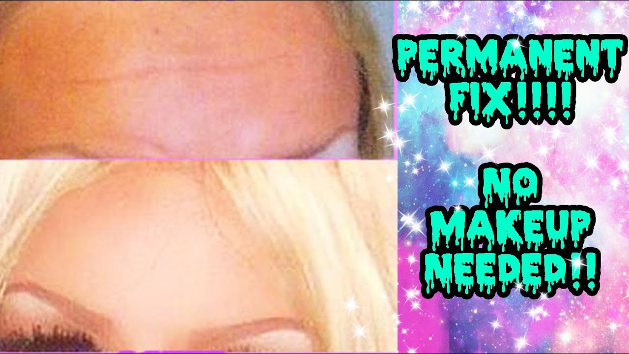 Natural Alternative to BOTOX! (For £1!)