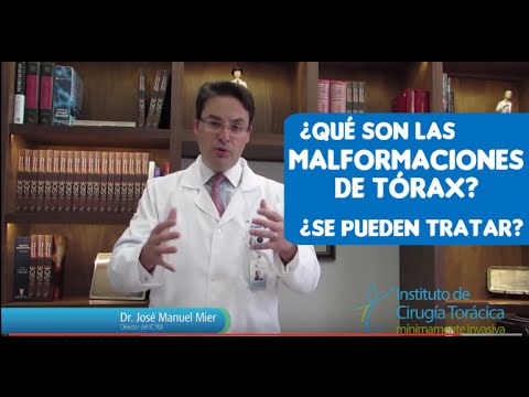 Vídeo: Deformidad Del Tórax: 5 Métodos Modernos De Tratamiento