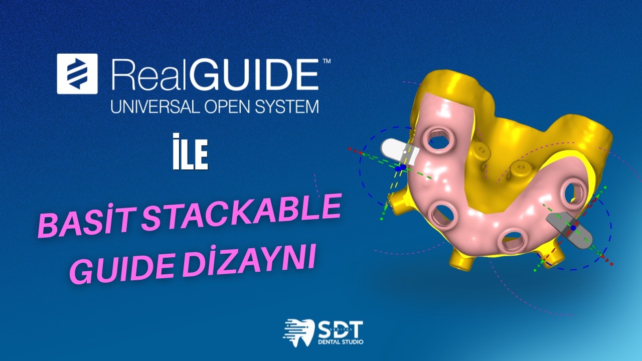 Stackable Guide Real Guide RealGUIDE 6.0 ile Basit Stackable Guide // How To Make Basic Stackable ...