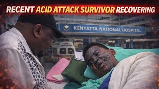 Breaking Sda Lady Attacked With Acid Finally Speaks After Mike Sonko Visits Mary Claire