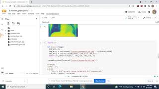 How to build an very accurate convolutional neural network that predicts pneumonia or not.