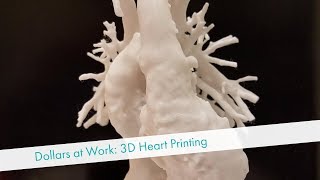 Children’s Miracle Network Dollars at Work: 3D Heart Printing